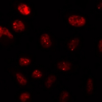 DNMT / DNMT1 Antibody