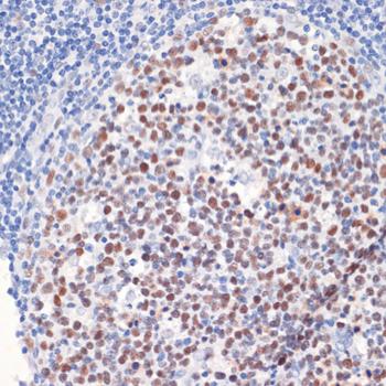 DNMT / DNMT1 Antibody - Immunohistochemistry of paraffin-embedded Human tonsil using DNMT1 Polyclonal Antibody at dilution of 1:200 (40x lens).