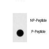 DNMT / DNMT1 Antibody - Dot blot of anti-Phospho-Dnmt1-pS154 Antibody on nitrocellulose membrane. 50ng of Phospho-peptide or Non Phospho-peptide per dot were adsorbed. Antibody working concentrations are 0.5ug per ml.