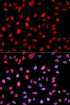 DNMT / DNMT1 Antibody - Immunofluorescence analysis of MCF7 cells.