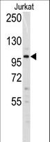 DNMT3A Antibody - Western blot of anti-Dnmt3a Antibody (N-term R46) in Jurkat cell line lysates (35 ug/lane). Dnmt3a(arrow) was detected using the purified antibody.