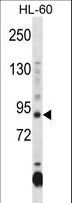 DNMT3A Antibody - DNMT3A Antibody (CenterR478) western blot of HL-60 cell line lysates (35 ug/lane). The DNMT3A antibody detected the DNMT3A protein (arrow).