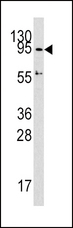 DNMT3A Antibody - Western blot of DNMT3A Antibody in HepG2 cell line lysates (35 ug/lane). DNMT3A (arrow) was detected using the purified antibody.