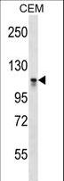 DNMT3A Antibody - DNMT3A Antibody (C-term V897) western blot of CEM cell line lysates (35 ug/lane). The DNMT3A antibody detected the DNMT3A protein (arrow).