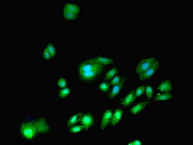 DNMT3A Antibody - Immunofluorescent analysis of HepG2 cells using DNMT3A Antibody at dilution of 1:100 and Alexa Fluor 488-congugated AffiniPure Goat Anti-Rabbit IgG(H+L)