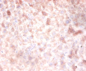 DNMT3A Antibody - Immunohistochemistry of paraffin-embedded Mouse liver tissue using DNMT3A Antibody at dilution of 1:100