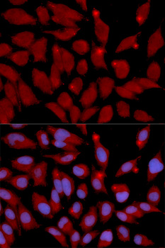 DNMT3A Antibody - Immunofluorescence analysis of U2OS cells.