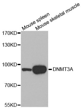 DNMT3A Antibody - Western blot analysis of extracts of various cell lines.
