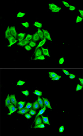 DNMT3A Antibody - Immunofluorescence analysis of A549 cells.
