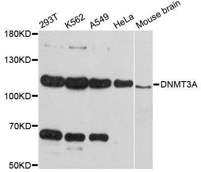DNMT3A Antibody - Western blot analysis of extracts of various cell lines, using DNMT3A antibody at 1:3000 dilution. The secondary antibody used was an HRP Goat Anti-Rabbit IgG (H+L) at 1:10000 dilution. Lysates were loaded 25ug per lane and 3% nonfat dry milk in TBST was used for blocking. An ECL Kit was used for detection and the exposure time was 30s.