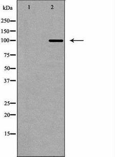 DNMT3A Antibody - Western blot analysis of HeLa whole cells lysates using DNMT3A antibody. The lane on the left is treated with the antigen-specific peptide.