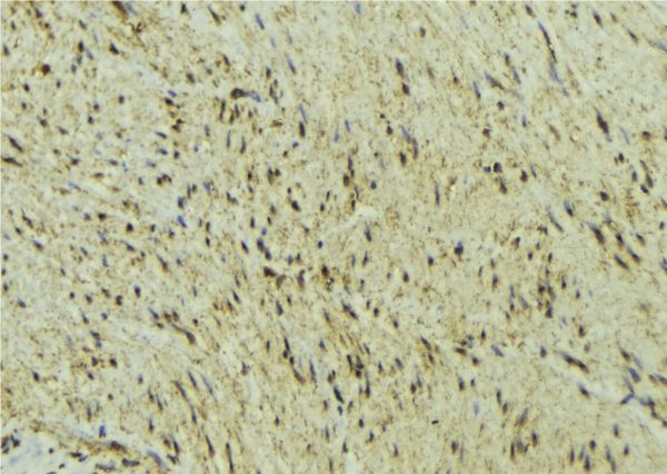 DNMT3A Antibody - 1:100 staining mouse muscle tissue by IHC-P. The sample was formaldehyde fixed and a heat mediated antigen retrieval step in citrate buffer was performed. The sample was then blocked and incubated with the antibody for 1.5 hours at 22°C. An HRP conjugated goat anti-rabbit antibody was used as the secondary.