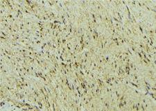DNMT3A Antibody - 1:100 staining mouse muscle tissue by IHC-P. The sample was formaldehyde fixed and a heat mediated antigen retrieval step in citrate buffer was performed. The sample was then blocked and incubated with the antibody for 1.5 hours at 22°C. An HRP conjugated goat anti-rabbit antibody was used as the secondary.