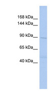 DNMT3B Antibody - DNMT3B antibody Western blot of OVCAR-3 cell lysate. This image was taken for the unconjugated form of this product. Other forms have not been tested.