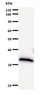 DNMT3B Antibody - Western blot of immunized recombinant protein using DNMT3B antibody.