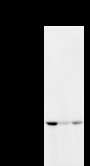 DNMT3B Antibody - Detection of DNMT3B by Western blot. Samples: Whole cell lysate from human HeLa (H, 50 ug) , mouse NIH3T3 (M, 50 ug) and rat F2408 (R, 50 ug) cells. Predicted molecular weight: 95 kDa
