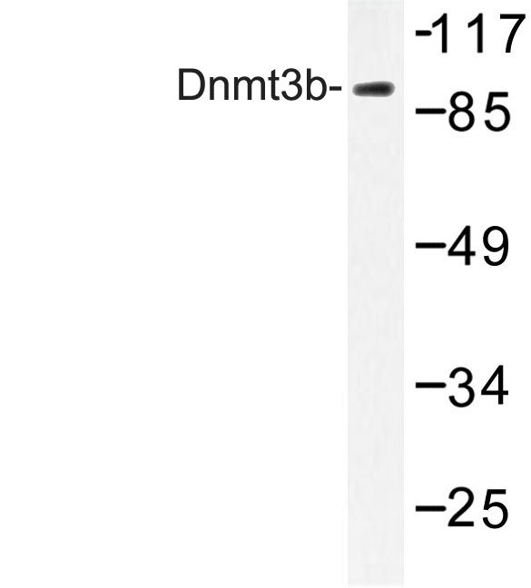 DNMT3B Antibody - Western blot of Dnmt3b (H7) pAb in extracts from HT-29 cells.