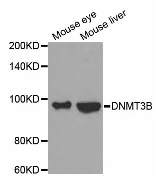 DNMT3B Antibody - Western blot analysis of extracts of various cell lines.