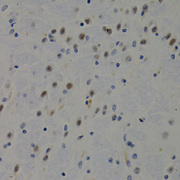 DNMT3B Antibody - Immunohistochemistry of paraffin-embedded mouse brain tissue.