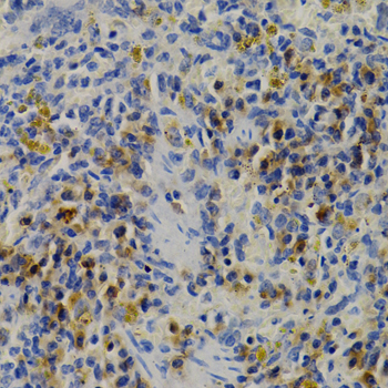 DNMT3B Antibody - Immunohistochemistry of paraffin-embedded mouse spleen tissue.