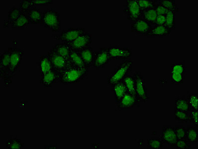DNMT3B Antibody - Immunofluorescent analysis of HepG2 cells diluted at 1:100 and Alexa Fluor 488-congugated AffiniPure Goat Anti-Rabbit IgG(H+L)