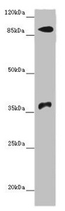 DNMT3B Antibody - Western blot All Lanes: DNMT3B antibody at 14 ug/ml+ Hela whole cell lysate Secondary Goat polyclonal to rabbit IgG at 1/10000 dilution Predicted band size: 96,94,87,81,89,95,78,82 kDa Observed band size: 96,37 kDa