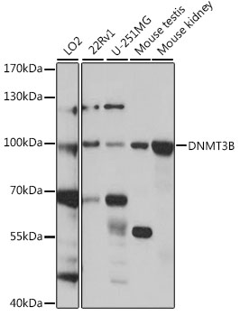DNMT3B Antibody - Western blot analysis of extracts of various cell lines, using DNMT3B antibody at 1:1000 dilution. The secondary antibody used was an HRP Goat Anti-Rabbit IgG (H+L) at 1:10000 dilution. Lysates were loaded 25ug per lane and 3% nonfat dry milk in TBST was used for blocking. An ECL Kit was used for detection and the exposure time was 15s.