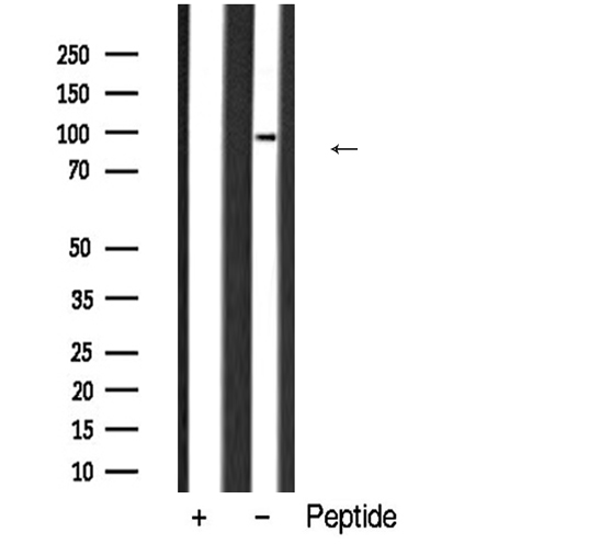DNMT3B Antibody - Western blot analysis of DNMT3B expression in HeLa cells lysate