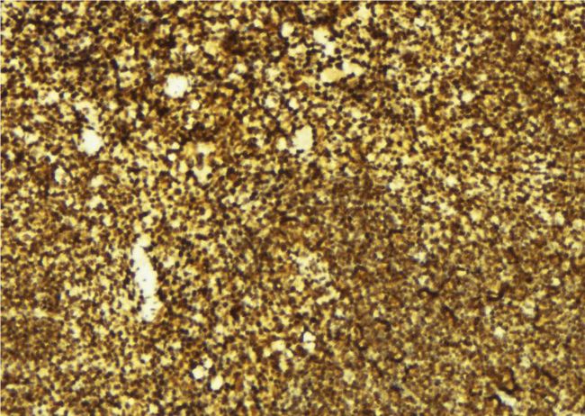 DNMT3B Antibody - 1:100 staining mouse spleen tissue by IHC-P. The sample was formaldehyde fixed and a heat mediated antigen retrieval step in citrate buffer was performed. The sample was then blocked and incubated with the antibody for 1.5 hours at 22°C. An HRP conjugated goat anti-rabbit antibody was used as the secondary.