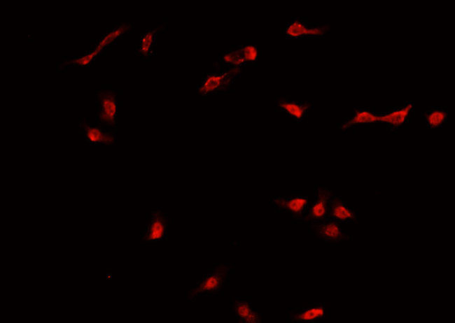 DNMT3B Antibody - Staining HT29 cells by IF/ICC. The samples were fixed with PFA and permeabilized in 0.1% Triton X-100, then blocked in 10% serum for 45 min at 25°C. The primary antibody was diluted at 1:200 and incubated with the sample for 1 hour at 37°C. An Alexa Fluor 594 conjugated goat anti-rabbit IgG (H+L) Ab, diluted at 1/600, was used as the secondary antibody.