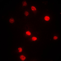 DNMT3B Antibody - Immunofluorescent analysis of DNMT3B staining in A549 cells. Formalin-fixed cells were permeabilized with 0.1% Triton X-100 in TBS for 5-10 minutes and blocked with 3% BSA-PBS for 30 minutes at room temperature. Cells were probed with the primary antibody in 3% BSA-PBS and incubated overnight at 4 C in a humidified chamber. Cells were washed with PBST and incubated with a DyLight 594-conjugated secondary antibody (red) in PBS at room temperature in the dark. DAPI was used to stain the cell nuclei (blue).