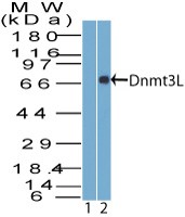 DNMT3L Antibody - Western Blot: Dnmt3L Antibody - Analysis of Dnmt3L using Dnmt3L antibody. GST tagged full length recombinant Human Dnmt3L in the 1) pre immune sera and 2) absence of immunizing peptide, probed with 2 ug/ml of Dnmt3L antibody. Goat anti-rabbit Ig HRP secondary antibody and PicoTect ECL substrate solution were used for this test.