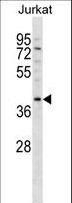 DNMT3L Antibody - DNMT3L Antibody western blot of Jurkat cell line lysates (35 ug/lane). The DNMT3L antibody detected the DNMT3L protein (arrow).