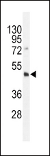 DNMT3L Antibody - Dnmt3L-R322 western blot of HL-60 cell line lysates (35 ug/lane). The DNMT3L antibody detected the DNMT3L protein (arrow).