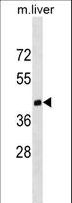DNMT3L Antibody - Dnmt3l Antibody (C403) western blot of mouse liver tissue lysates (35 ug/lane). The Dnmt3l antibody detected the Dnmt3l protein (arrow).