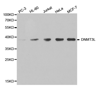 DNMT3L Antibody - Western blot analysis of extracts of various cell lines.