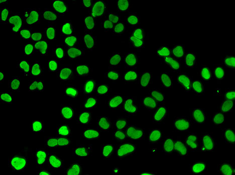 DNMT3L Antibody - Immunofluorescence analysis of A549 cells.