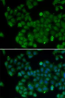 DNMT3L Antibody - Immunofluorescence analysis of U20S cells.