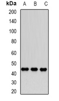 DNMT3L Antibody - Western blot analysis of Dnmt3L expression in PC3 (A); Jurkat (B); MCF7 (C) whole cell lysates.