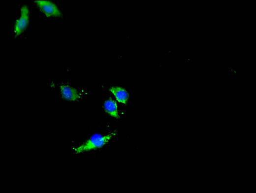 DNMT3L Antibody - Immunofluorescent analysis of Hela cells using DNMT3L Antibody at a dilution of 1:100 and Alexa Fluor 488-congugated AffiniPure Goat Anti-Rabbit IgG(H+L)