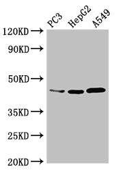 DNMT3L Antibody - Western Blot Positive WB detected in: PC-3 whole cell lysate, HepG2 whole cell lysate, A549 whole cell lysate All lanes: DNMT3L antibody at 3.4µg/ml Secondary Goat polyclonal to rabbit IgG at 1/50000 dilution Predicted band size: 44 kDa Observed band size: 44 kDa