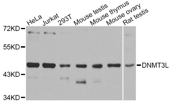 DNMT3L Antibody - Western blot analysis of extracts of various cell lines, using DNMT3L antibody at 1:1000 dilution. The secondary antibody used was an HRP Goat Anti-Rabbit IgG (H+L) at 1:10000 dilution. Lysates were loaded 25ug per lane and 3% nonfat dry milk in TBST was used for blocking. An ECL Kit was used for detection and the exposure time was 30s.