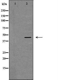 DNMT3L Antibody - Western blot analysis of HeLa whole cells lysates using DNMT3L antibody. The lane on the left is treated with the antigen-specific peptide.