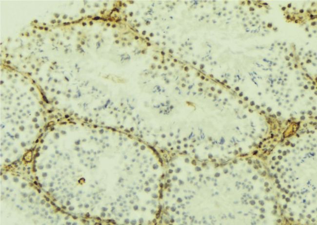 DNMT3L Antibody - 1:100 staining mouse testis tissue by IHC-P. The sample was formaldehyde fixed and a heat mediated antigen retrieval step in citrate buffer was performed. The sample was then blocked and incubated with the antibody for 1.5 hours at 22°C. An HRP conjugated goat anti-rabbit antibody was used as the secondary.