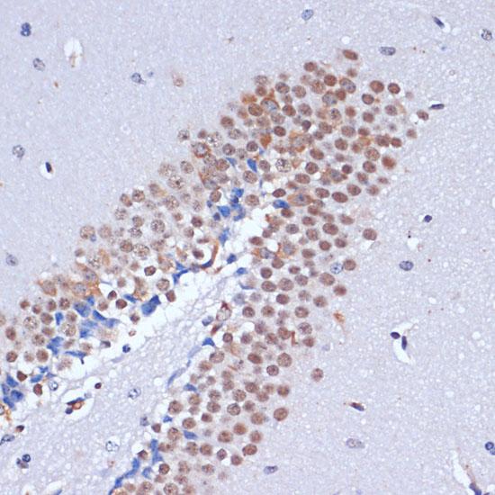 DNMT3L Antibody - Immunohistochemistry of paraffin-embedded Mouse brain using DNMT3L Polyclonal Antibody at dilution of 1:100 (40x lens).