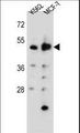DNPEP Antibody - DNPEP Antibody western blot of K562,MCF-7 cell line lysates (35 ug/lane). The DNPEP antibody detected the DNPEP protein (arrow).