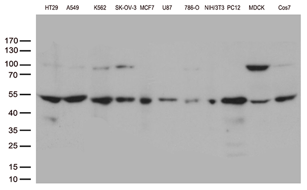 DNPEP Antibody - Western blot analysis of extracts. (35ug) from 11 different cell lines by using anti-DNPEP monoclonal antibody. (1:500)