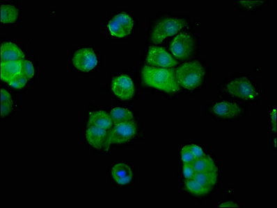 DNPEP Antibody - Immunofluorescence staining of MCF-7 cells at a dilution of 1:200, counter-stained with DAPI. The cells were fixed in 4% formaldehyde, permeabilized using 0.2% Triton X-100 and blocked in 10% normal Goat Serum. The cells were then incubated with the antibody overnight at 4 °C.The secondary antibody was Alexa Fluor 488-congugated AffiniPure Goat Anti-Rabbit IgG (H+L) .
