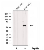 DNPEP Antibody - Western blot analysis of extracts of HEK293 cells using DNPEP antibody. The lane on the left was treated with blocking peptide.