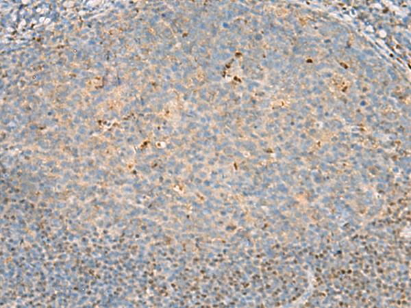 DNPEP Antibody - Immunohistochemistry of paraffin-embedded Human tonsil tissue  using DNPEP Polyclonal Antibody at dilution of 1:60(×200)